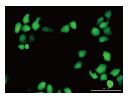 Plate Culture Cell TC voatsabo, TC Enhanced fitsaboana, Ultra-low binding fitsaboana (9)